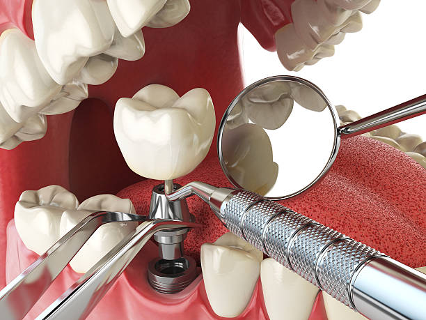 Best Same-Day Emergency Dental Services in St Clair, MI