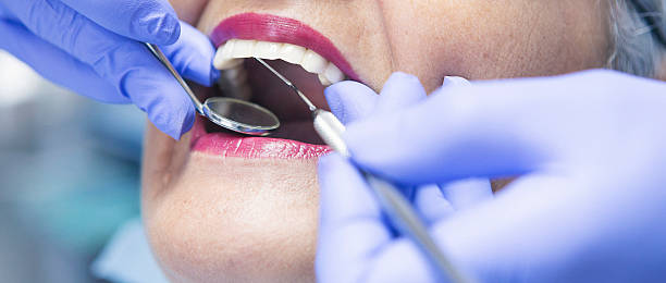 Best Emergency Gum Treatment in St Clair, MI